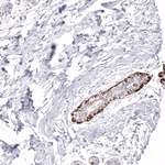 Cytokeratin 14 Antibody in Immunohistochemistry (Paraffin) (IHC (P))