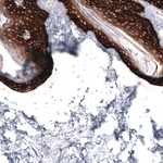 Cytokeratin 14 Antibody in Immunohistochemistry (Paraffin) (IHC (P))