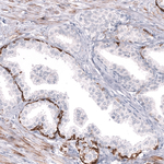 Cytokeratin 14 Antibody in Immunohistochemistry (Paraffin) (IHC (P))