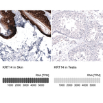 Cytokeratin 14 Antibody in Immunohistochemistry (Paraffin) (IHC (P))