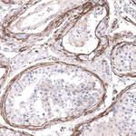 ITGB1 Antibody in Immunohistochemistry (Paraffin) (IHC (P))