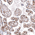 ITGB1 Antibody in Immunohistochemistry (Paraffin) (IHC (P))