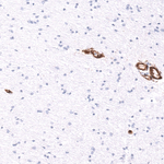 ITGB1 Antibody in Immunohistochemistry (Paraffin) (IHC (P))