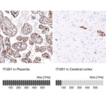 ITGB1 Antibody in Immunohistochemistry (Paraffin) (IHC (P))
