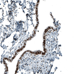 Androgen Receptor Antibody in Immunohistochemistry (Paraffin) (IHC (P))