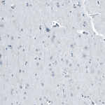 Androgen Receptor Antibody in Immunohistochemistry (Paraffin) (IHC (P))