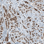 Androgen Receptor Antibody in Immunohistochemistry (Paraffin) (IHC (P))