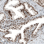 Androgen Receptor Antibody in Immunohistochemistry (Paraffin) (IHC (P))