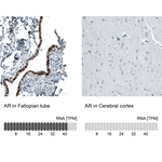 Androgen Receptor Monoclonal Antibody (CL9255)