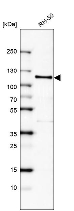 Androgen Receptor Antibody in Western Blot (WB)