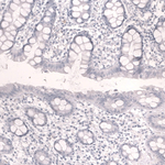 Cardiac Troponin T Antibody in Immunohistochemistry (Paraffin) (IHC (P))