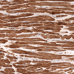 Cardiac Troponin T Antibody in Immunohistochemistry (Paraffin) (IHC (P))