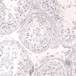 Cardiac Troponin T Antibody in Immunohistochemistry (Paraffin) (IHC (P))