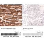 Cardiac Troponin T Monoclonal Antibody (CL13382)