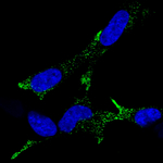Chromogranin A Monoclonal Antibody (CL0166)