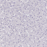 Chromogranin A Antibody in Immunohistochemistry (Paraffin) (IHC (P))