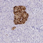 Chromogranin A Antibody in Immunohistochemistry (Paraffin) (IHC (P))