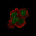 CHK2 Antibody in Immunocytochemistry (ICC/IF)