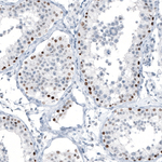 CHK2 Antibody in Immunohistochemistry (Paraffin) (IHC (P))
