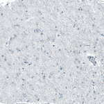 CHK2 Antibody in Immunohistochemistry (Paraffin) (IHC (P))