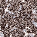 CHK2 Antibody in Immunohistochemistry (Paraffin) (IHC (P))