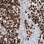 CHK2 Antibody in Immunohistochemistry (Paraffin) (IHC (P))