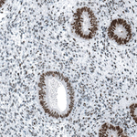 CHK2 Antibody in Immunohistochemistry (Paraffin) (IHC (P))