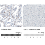 CHK2 Antibody in Immunohistochemistry (Paraffin) (IHC (P))