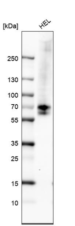 CHK2 Antibody in Western Blot (WB)