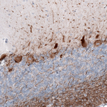 NF-H Antibody in Immunohistochemistry (Paraffin) (IHC (P))