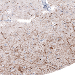 NF-H Antibody in Immunohistochemistry (Paraffin) (IHC (P))