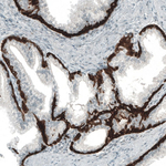 Cytokeratin 5 Antibody in Immunohistochemistry (Paraffin) (IHC (P))