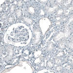 Cytokeratin 5 Antibody in Immunohistochemistry (Paraffin) (IHC (P))