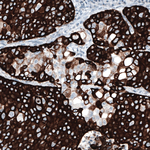 Cytokeratin 5 Antibody in Immunohistochemistry (Paraffin) (IHC (P))