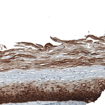 Cytokeratin 5 Antibody in Immunohistochemistry (Paraffin) (IHC (P))