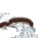 Cytokeratin 5 Antibody in Immunohistochemistry (Paraffin) (IHC (P))