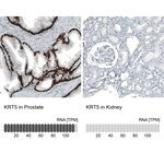 Cytokeratin 5 Antibody in Immunohistochemistry (Paraffin) (IHC (P))