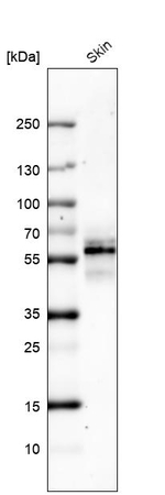 Cytokeratin 5 Antibody in Western Blot (WB)