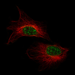 CRYAB Monoclonal Antibody (CL10758)