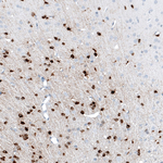 CRYAB Antibody in Immunohistochemistry (Paraffin) (IHC (P))