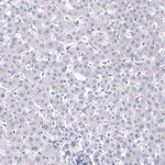 CRYAB Antibody in Immunohistochemistry (Paraffin) (IHC (P))