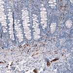 CRYAB Antibody in Immunohistochemistry (Paraffin) (IHC (P))