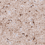 CRYAB Antibody in Immunohistochemistry (Paraffin) (IHC (P))