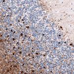 CRYAB Antibody in Immunohistochemistry (Paraffin) (IHC (P))
