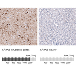 CRYAB Antibody in Immunohistochemistry (Paraffin) (IHC (P))