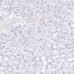 CRYAB Antibody in Immunohistochemistry (Paraffin) (IHC (P))