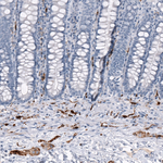 CRYAB Monoclonal Antibody (CL10765)