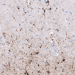 CRYAB Antibody in Immunohistochemistry (Paraffin) (IHC (P))
