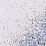 CRYAB Antibody in Immunohistochemistry (Paraffin) (IHC (P))