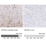 CRYAB Antibody in Immunohistochemistry (Paraffin) (IHC (P))